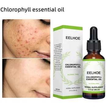 Chlorophyll Face Acne Essence Етерично масло - Овлажняващ Почистващо средство за Склонна към акне, суха, мазна кожа, 59 мл